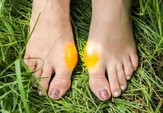 Ways to ease bunion pain